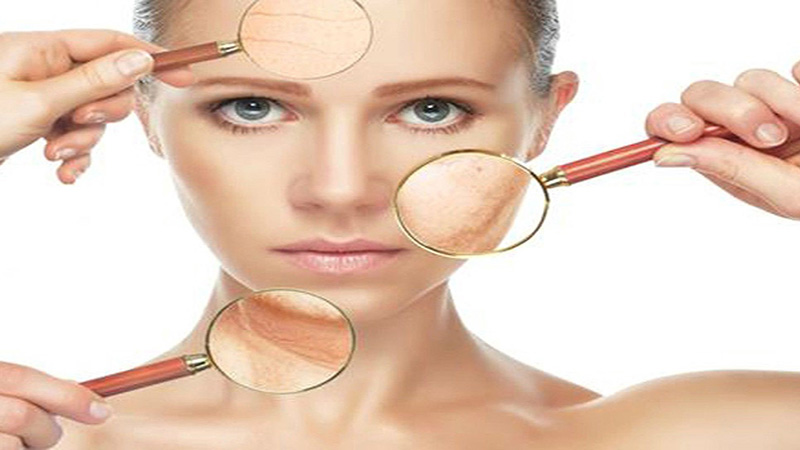 Hiểu chính xác về làn da hỗn hợp