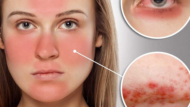Máy chăm sóc da mặt vẫn dùng được cho da nhạy cảm
