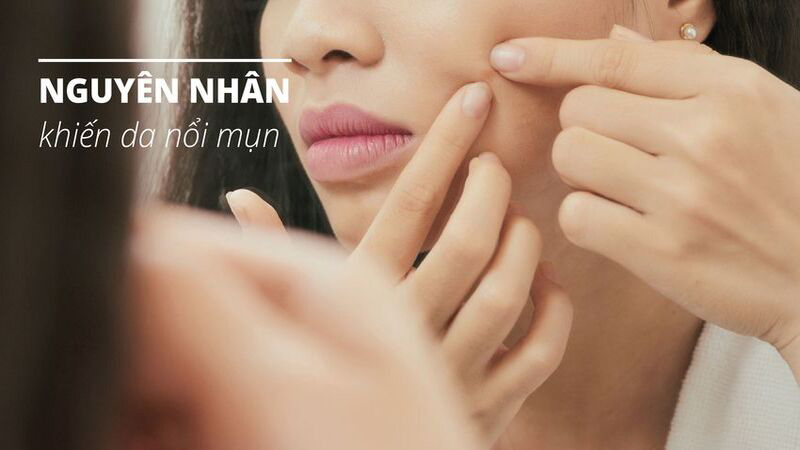 Có nhiều nguyên nhân khiến da nổi mụn