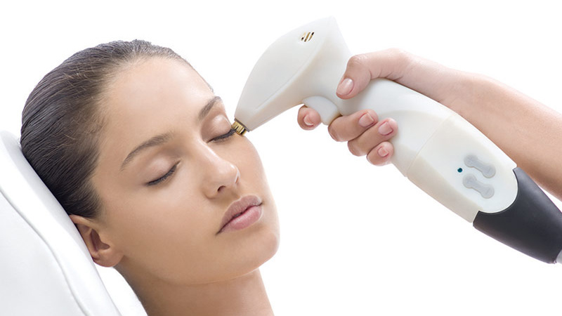 Khi trẻ hoá bằng laser, các bạn cần lưu ý một số thông tin