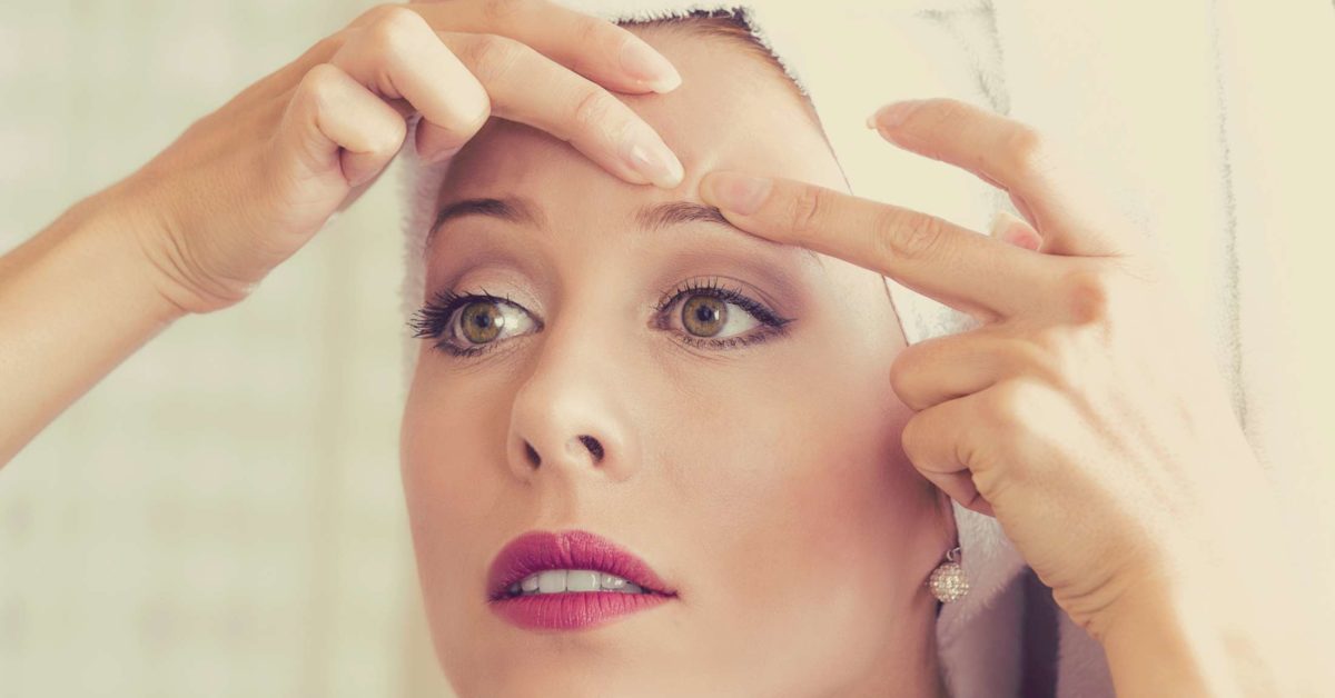 Mụn khiến bạn khó chịu và luôn muốn chúng biến mất nhanh chóng