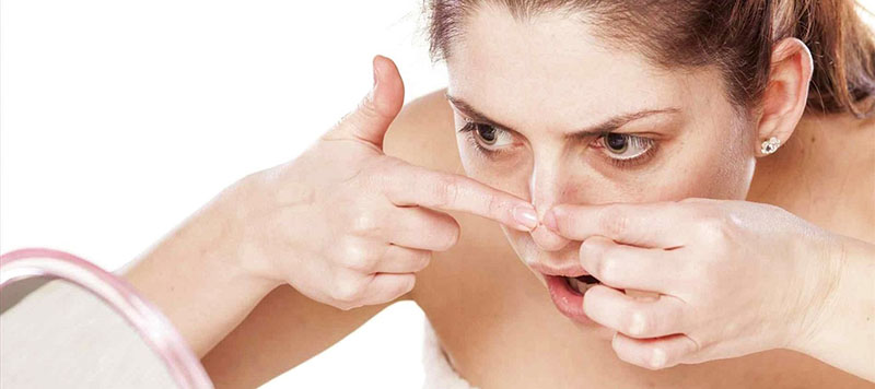 Tránh tự ý nặn mụn bằng tay