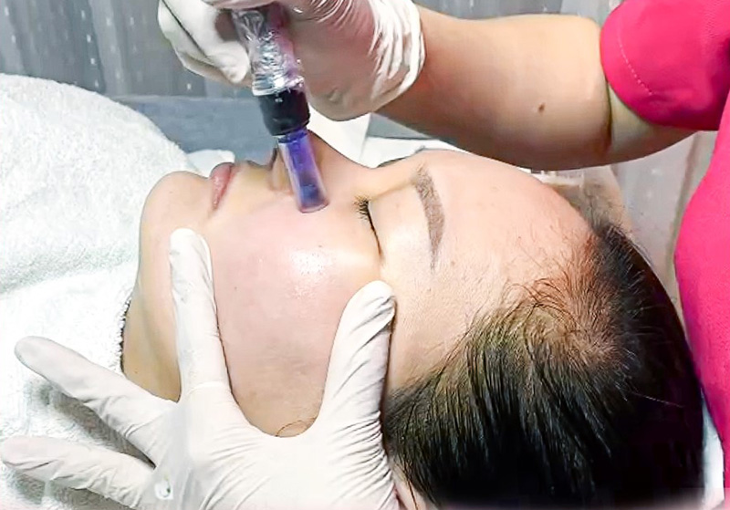 Chăm sóc da bằng bằng liệu trình chuyên sâu