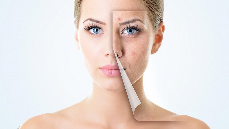 Điều trị bệnh lý cho da để da luôn khỏe, đẹp