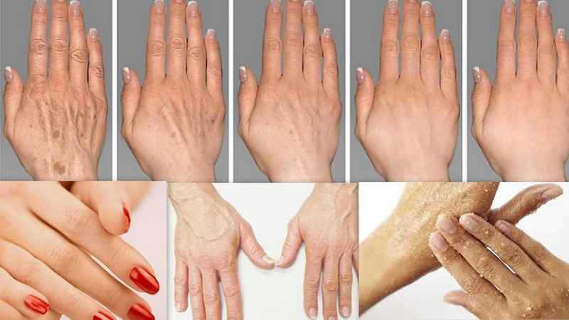 Tay là vùng da tiếp xúc bên ngoài nhiều nên dễ bị tổn thương