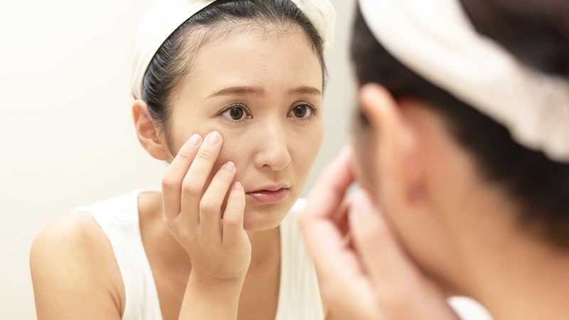 Kem dưỡng da có chứa chất bảo quản dễ gây tác dụng phụ