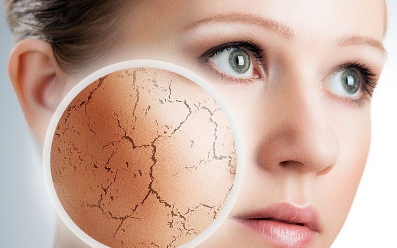 Nên sử dụng nước hoa hồng có thành phần dưỡng ẩm cho da khô