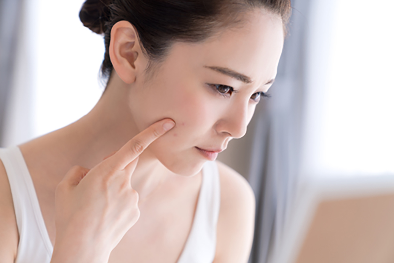 Mụn có thể phản ánh tình trạng sức khỏe của bản thân