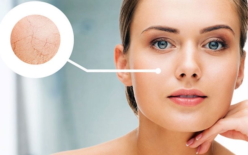 Sữa rửa mặt chứa cồn có thể làm khô da