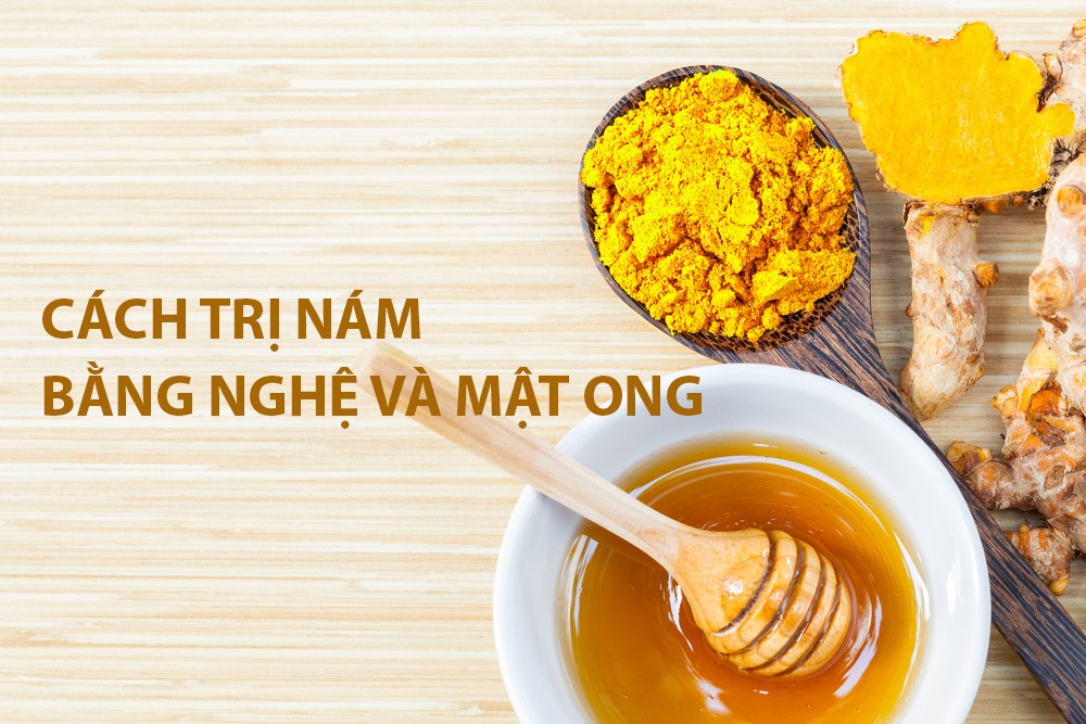 Trị nám da mặt tự nhiên từ nghệ và mật ong
